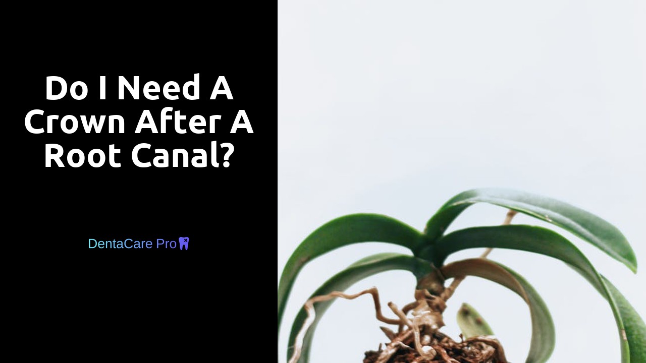 Do I need a crown after a root canal?